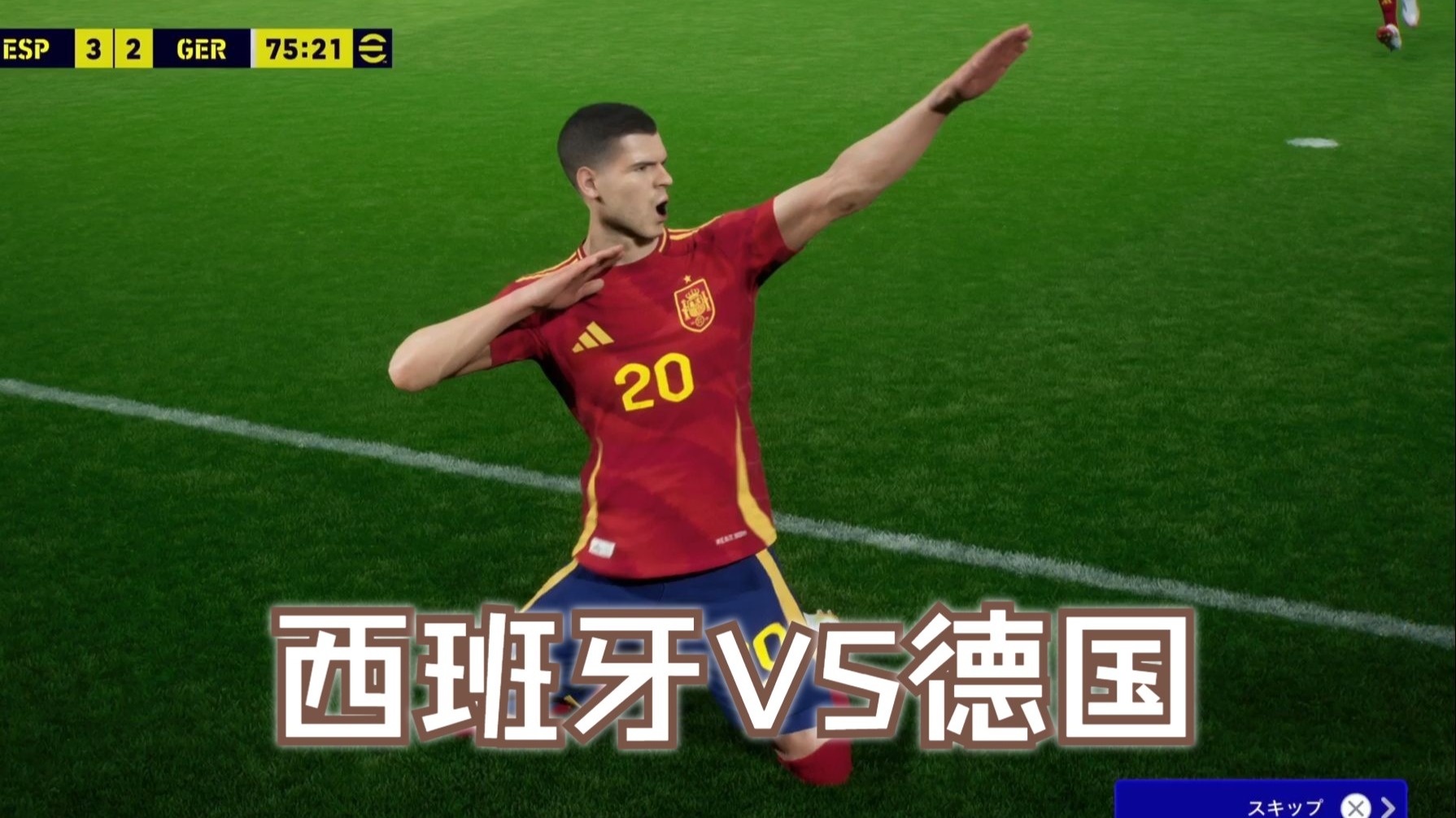 德国球员受伤，将缺席重要国家队比赛的简单介绍